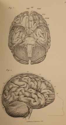 The Anatomy of the Brain; with a General View of the Nervous System