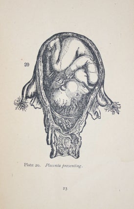 Plates Illustrating the Female Reproductive Organs