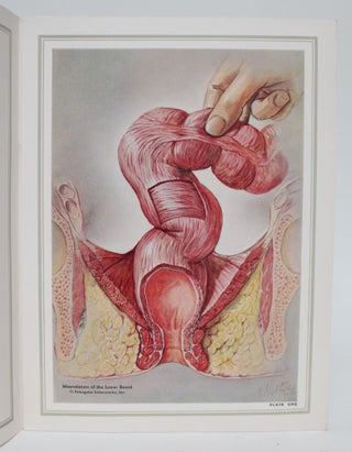 A Pictorial Anatomy of the Lower Bowel