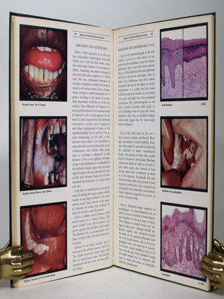 Color Atlas of Oral Pathology